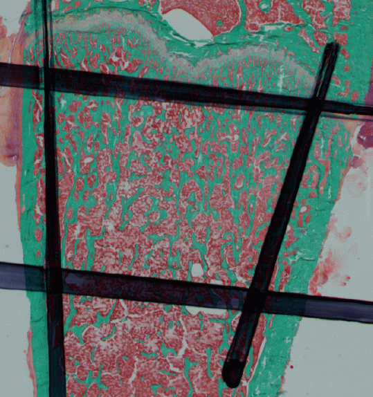 Image initiale de coupe histologique de l'os du fémur d'un rat